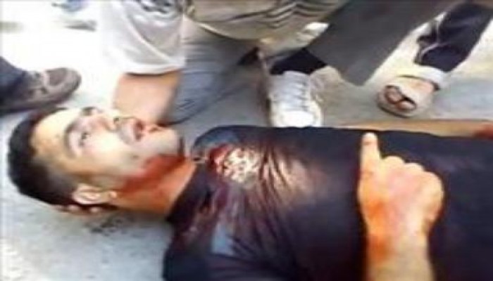 أكثر من 20 شهيداً فى جمعة البشائر على يد ( النازي ) بشار ومنع المصلين من أداء صلاة الجمعة
