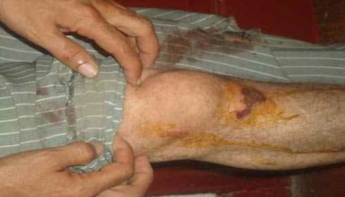 (كلاكيت ثالث مرة ) : د/ أحمد أبو بركه يتعرض للضرب والسحل أمام وزارة الداخلية