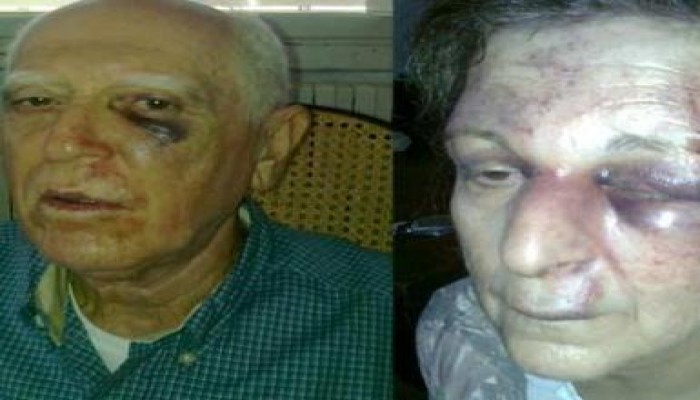 فنان سوري ينشر صوراً فظيعة لتعرض والديه العجوزين لضرب مبرح من الأمن