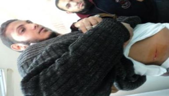 أنصار حزب الوسط بالمنيا يعتدون على عضو الحرية والعدالة ( بالسلاح الأبيض )