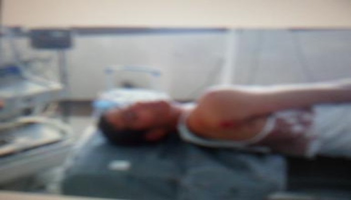 إصابة ابن أحد قيادات الإخوان بدمروا بالمحلة بالرصاص من قبل بلطجية حامد جهجه (صور)