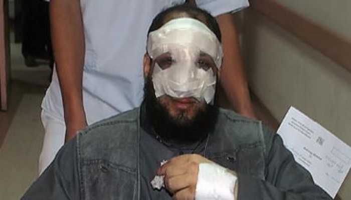 مجلس الشعب يوافق على رفع الحصانة عن البلكيمى