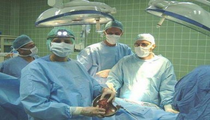 استئصال ورم يزن 21 كيلوجراما من بطن رجل في ألمانيا