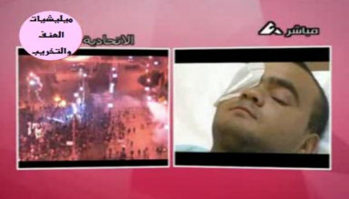 صرخة من عساكر الأمن المركزى: وقفنا ندافع عن المنشآت فأصبنا بالخرطوش (متلفز)