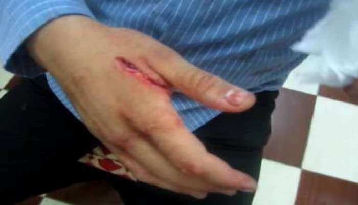 صور الاعتداء على اعضاء الحرية والعدالة واهالى الرمل بالاسكندرية من قبل بلطجية "تمرد"