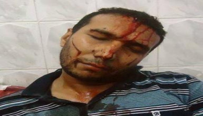 بلطجية "تمرد والحزب الوطني والتيار الشعبي" يعتدون على وفد نقابة المهندسين بالدقهلية