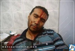 صورة وتعليق  إهداء من بلطجية جبهة الخراب لشعب مصر "سلمية ماتت"