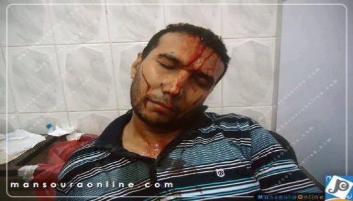 صورة وتعليق  إهداء من بلطجية جبهة الخراب لشعب مصر "سلمية ماتت"