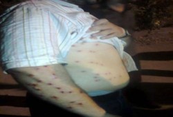 15 إصابة فى صفوف الإخوان بالمنوفية بعد تعدي بلطجية على  مسيرة حاشدة لتأييد الرئيس