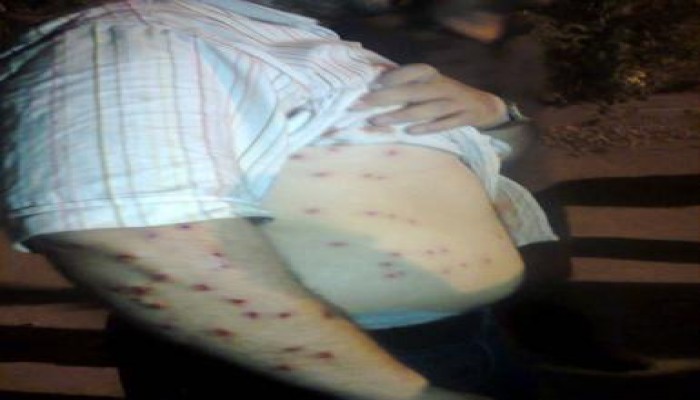 15 إصابة فى صفوف الإخوان بالمنوفية بعد تعدي بلطجية على  مسيرة حاشدة لتأييد الرئيس