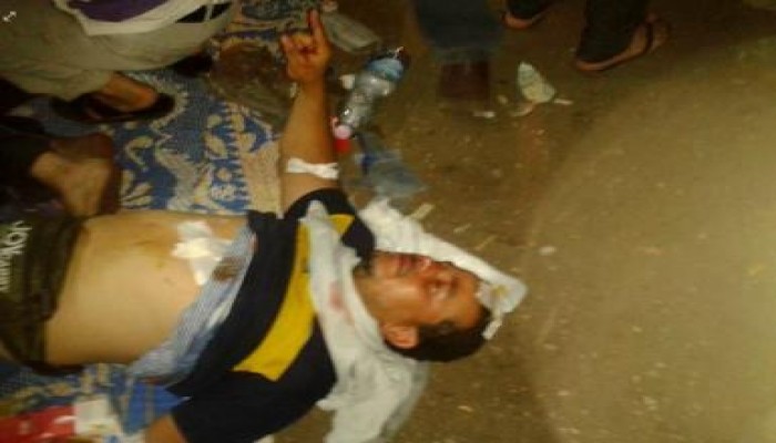 شهداء ومصابي مذبحة دار الحرس الجمهوري التي ارتكبها الخائن السيسي (صور)