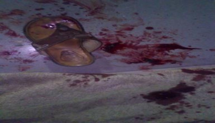 دماء الأبرياء العزل برصاص الشرطة والجيش على عتبات صلاة الفجر بالحرس الجمهوري ( مصور )