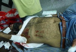 شهداء أبرار .. ومصابون أطهار .. مصلون للفجر .. بمذبحة السيسي الخائن ( مصور )