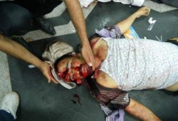 د. عصام العريان : مذبحة بالحرس الجمهوري وشهداء بانفجار بالمخ ، والدم سيهزم الرصاص