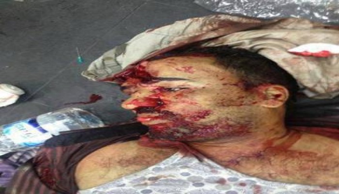 موقف الإعلام المصري ( الرسمي والخاص ) من المذبحة