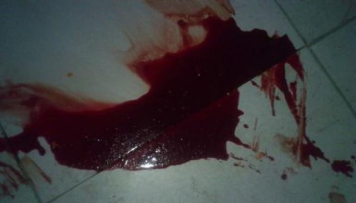 السيسي الخائن ينصب مذبحة للمصريين وخونة الفضائيات المصرية الرسمية والخاصة يتجاهلون