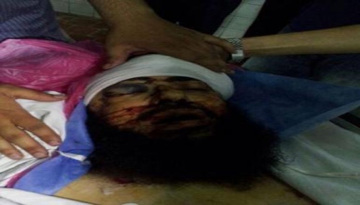 المحلة ترتدي السواد حزنا علي استشهاد مصطفي حامد علي يد بلطجية السيسي