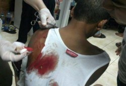 الشرطة تطلق الغاز المسيل للدموع على معتصمى النهضة .. والبلطجية يطلقون الخرطوش فى حمايتهم