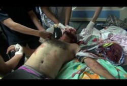 سقوط عشرات المصابين بالرصاص الحي أطلق عليهم من قسم شرطة أول مدينة نصر