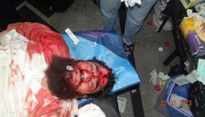 صور  المصابين في مذبحة الفجر برصاص ضباط قسم أول مدينة  نصر