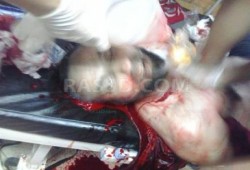 6 شهداء حتى الان 4 بميدان النهضه و 2 برابعه العدوية