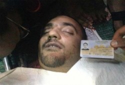 طبيب المستشفى الميدانى بالنهضة: البلطجية مثلوا بجثة الشهيد حسام الدين صادق