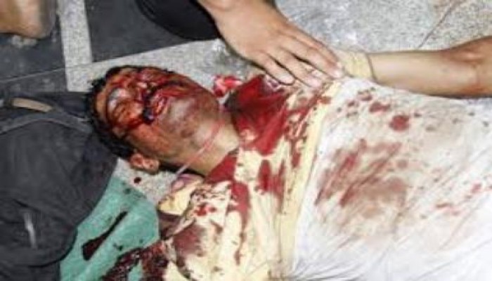 ننشر أسماء مصابي مجزرة النهضة ونوع الاصابة