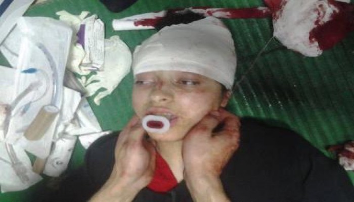 قناصة السيسي يقنصون الأطفال (عارُُ عليكم)