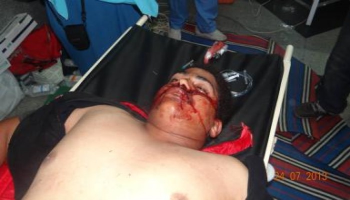 الجزيرة مباشر مصر : شهيدان وعشرات الإصابات فى المسيرة القادمة من شبرا