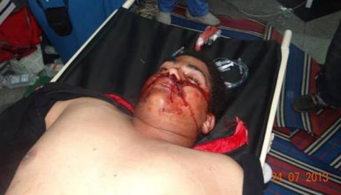 السيسي يواصل المذابح ضد الشعب المصري واستشهاد اثنين في مسيرة شبرا بنيران في الرأس