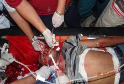 مدير المستشفى الميداني برابعة: الوضع خطير ونستغيث لوقف المذبحة وإنقاذ المئات من الموت