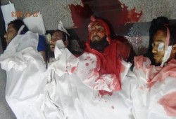 ارتفاع عدد شهداء "المنصة"إلى اكثر من  100 شهيد وأكثر من 2000مصاب