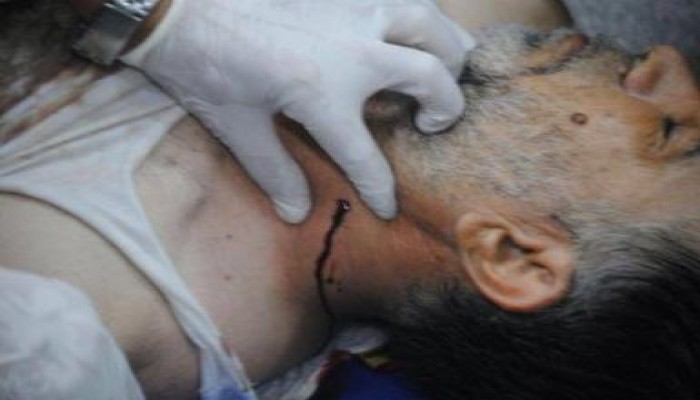 فيديوهات  من مجزرة المنصة (فشل التفويض)