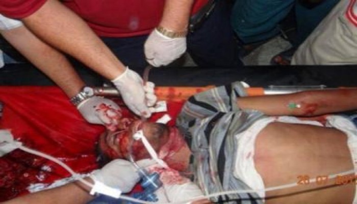 مراسل صحفي ما يحدث في رابعة لم أره إلا في الحروب  الدولية ، ومجازر السيسي إجرام حرب