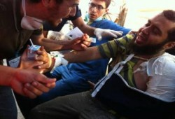 "صمودكم وثباتكم أذهل العالم": مصاب بمجزرة المنصة يرفض ان يفطر رغم شدة جراحه