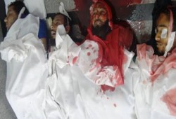 "هيومن رايتس واتش": تصعيد العنف ضد مؤيدي مرسي صادم