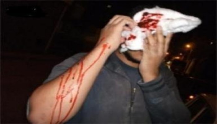 بلطجية برعاية الشرطة يعتدون على المصلين بالمنصورة بالخرطوش والرصاص الحي