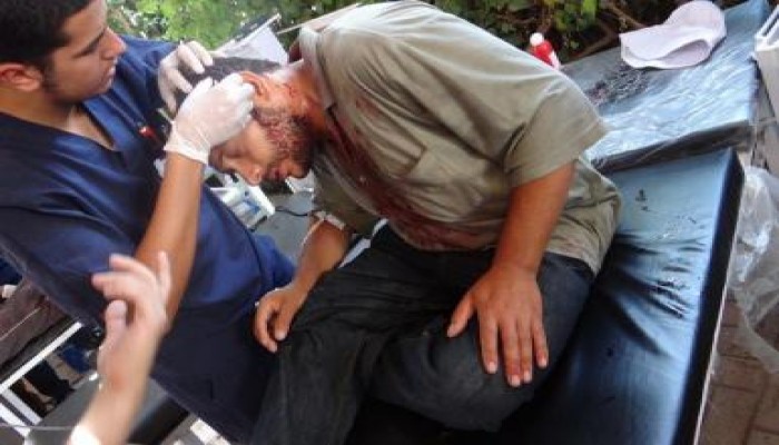 اصابة 8 من المتظاهرين نتيجة اعتداء البلطجية على مسيرة السيدة زينب