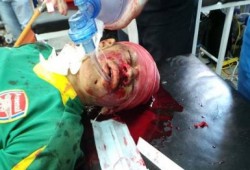 السيسي الفاجر علي خطي بشار وبداية جديدة في إراقة دماء الشعب شهداء وجرحي جدد