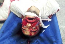 صور أول شهداء بنيران السيسي حسبنا الله ونعم الوكيل الضرب من خلال قناصة في الرأس والرقبة