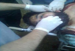 صهاينة السيسي .. يعتقلون حسام أبو البخاري ثم يطلقون عليه النار ويتركونه مضرجاً في دمائه