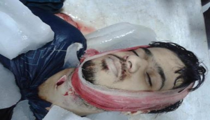 اليوم تشييع جثمان الشهيد أحمد سامي ضحية رصاص الغدر في رقبته