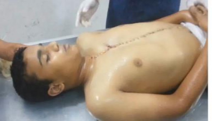 بالفيديو آثار الطلق الناري في صدر محمد مصطفى حافظ كتاب الله