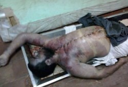 شهود عيان : آثار الحرق والتعذيب على جثث مذبحة أبو زعبل تفضح رواية الداخلية