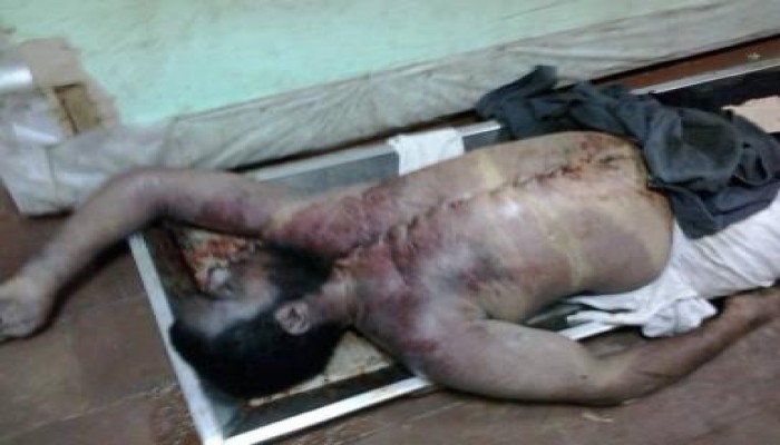 شهود عيان : آثار الحرق والتعذيب على جثث مذبحة أبو زعبل تفضح رواية الداخلية