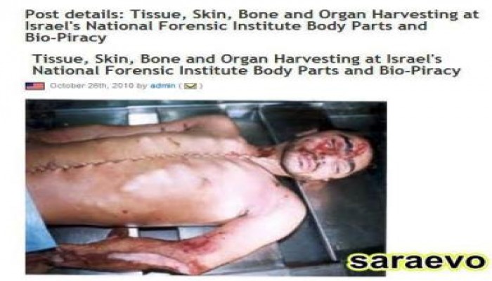 مصيبة وفضيحة من العيار الثقيل خطير جدا حرق الشهداء للتغطية علي جريمة سرقة الأعضاء