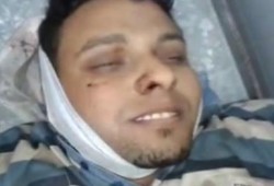 بالفيديو .. في مثل هذ اليوم من اسبوع مضى ... ابتسامة الشهيد