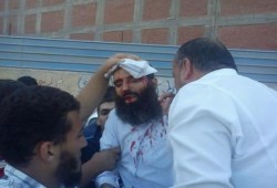 بالصور بلطجية الداخلية يفشلون في كسر إرادة الثوار رغم النيران والخرطوش