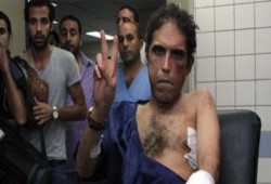 الحرية والعدالة يدين الاعتداء على خالد داود