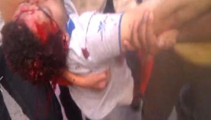 بالفيديو شهيد بطلقه في الرأس الان من قوات جيش الانقلاب